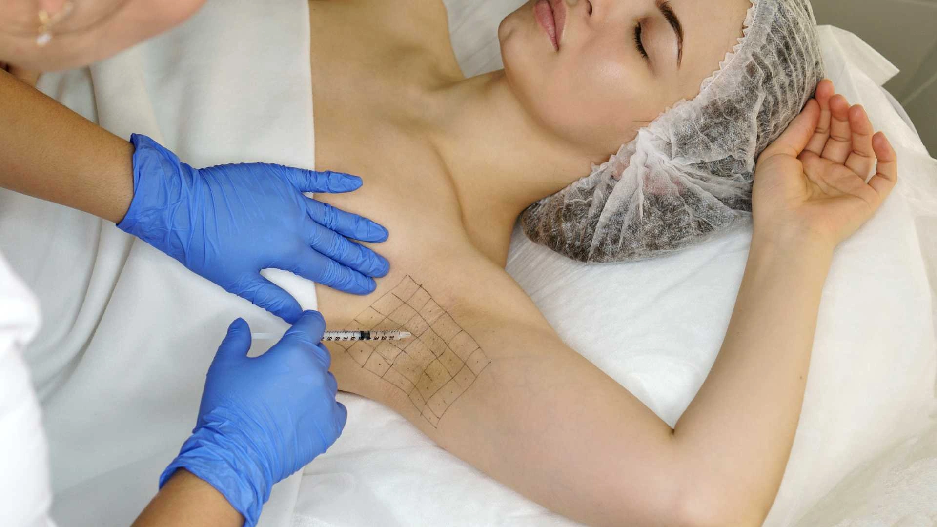 Botox Ketiak: Solusi Ampuh Atasi Keringat dan Bau Badan