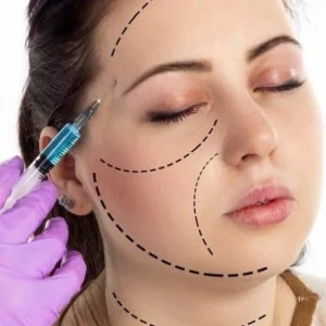 menyingkap-rahasia-wajah-awet-muda-dengan-allergan-botox