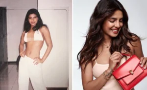 tren-glow-up-artis-india-ini-jenis-operasi-yang-dipilih-selain-botox