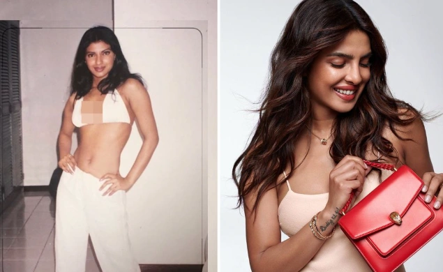 tren-glow-up-artis-india-ini-jenis-operasi-yang-dipilih-selain-botox