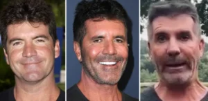 simon-cowell-berhenti-pakai-filler