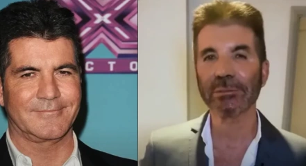 simon-cowell-berhenti-pakai-filler